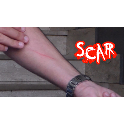 SCAR by Dan Alex Video DOWNLOAD